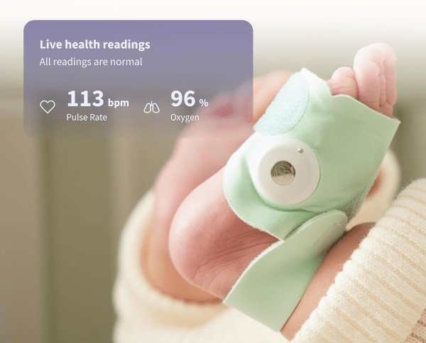 Dream Sock Owlet Baby Monitor